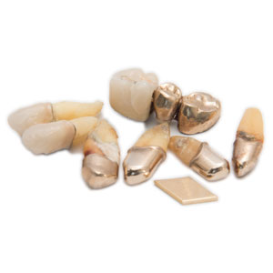 Zahn Gold